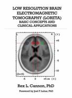 Low Resolution Brain Electromagnetic Tomography (Loreta): Basic Concepts and Clinical Applications 0982749813 Book Cover