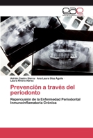 Prevención a través del periodonto 6200343640 Book Cover