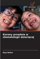 Korony przednie w stomatologii dzieciecej 6209114539 Book Cover