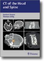 CT of the Head and Spine 3131267119 Book Cover