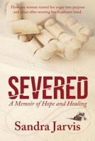 Severed: A Memoir of Hope and Healing 1733963200 Book Cover