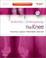 Arthritis and Arthroplasty: the Knee 1416049746 Book Cover