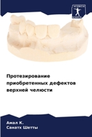 Протезирование приобретенных дефектов верхней челюсти 6206322521 Book Cover