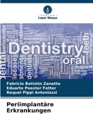 Periimplantäre Erkrankungen (German Edition) 6208693837 Book Cover