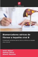 Biomarcadores séricos de fibrose e hepatite viral B (Portuguese Edition) 6208831717 Book Cover