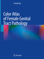 Color Atlas of Female Genital Tract Pathology 9811310289 Book Cover