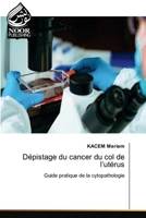 Dépistage du cancer du col de l'utérus 6200044252 Book Cover