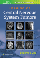 Imaging of CNS Tumors 1975103742 Book Cover