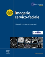 Imagerie cervicofaciale: Massif facial - Sinus - Voies aérodigestives supérieures - Pathologies cervicales - Espaces profonds de la face (French Edition) 2294775953 Book Cover