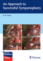 An Approach to Successful Tympanoplasty 939539093X Book Cover