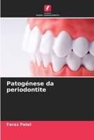 Patogénese da periodontite (Portuguese Edition) 6206576345 Book Cover