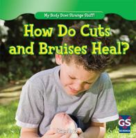 How Do Cuts and Bruises Heal? 1482402416 Book Cover