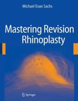 Mastering Revision Rhinoplasty 0387989048 Book Cover