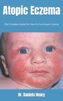 Atopic Eczema: The Complete Guide On How To Cure Atopic Eczema B09FS127QJ Book Cover