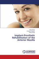 Implant-Prosthetic Rehabilitation of the Anterior Maxilla 613839061X Book Cover