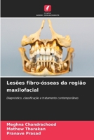 Lesões fibro-ósseas da região maxilofacial (Portuguese Edition) 6209467776 Book Cover