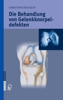 Die Behandlung Von Gelenkknorpeldefekten 3798514666 Book Cover
