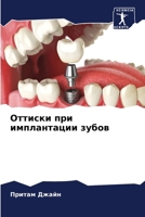 Оттиски при имплантации 6205623161 Book Cover