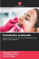 Ortodontia acelerada: Revolucionando os sorrisos com um tratamento mais rápido e mais inteligente (Portuguese Edition) 6208696585 Book Cover