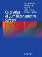 Color Atlas of Burn Reconstructive Surgery 3662501589 Book Cover