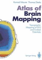 Atlas of Brain Mapping: Topographic Mapping of Electroencephalography and Evoked Potentials 3642760457 Book Cover