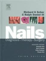 Nails: Therapy, Diagnosis, Surgery 0721679692 Book Cover