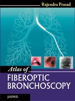 Atlas of Fiberoptic Bronchoscopy 9350903407 Book Cover