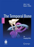 Temporal Bone: An Imaging Atlas 364202209X Book Cover