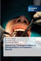 Implant as Treatment option in Rehabilitation of Posterior Maxilla 6138947878 Book Cover