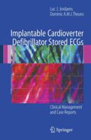 Implantable Cardioverter Defibrillator Stored ECGs: Clinical Management and Case Reports 1846286794 Book Cover