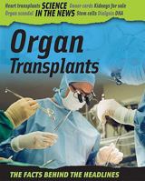 Organ Transplants 1599203219 Book Cover