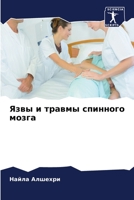 Язвы и травмы спинного мозга 6205728672 Book Cover