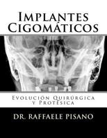 Implantes Cigomáticos: Evolución Quirúrgica y Protésica 1983850160 Book Cover