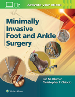 Minimally Invasive Foot  Ankle Surgery 1451131615 Book Cover