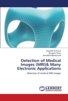Detection of Medical Images (MRI)& Many Electronic Applications: detection of medical MRI images 3659474622 Book Cover