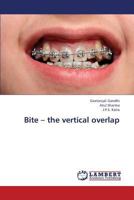 Bite – the vertical overlap 365933538X Book Cover