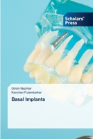 Basal Implants 6205521768 Book Cover