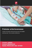 Fístulas arteriovenosas 6205285150 Book Cover
