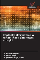 Implanty skrzydlowe w rehabilitacji zanikowej szczęki 6209081665 Book Cover