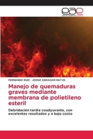 Manejo de quemaduras graves mediante membrana de polietileno esteril (Spanish Edition) 620977587X Book Cover