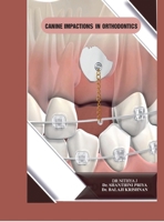 Canine Impactions in Orthodontics B0G5PNGSBN Book Cover