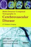 Multidetector Computed Tomography in Cerebrovascular Disease: CT Perfusion Imaging: CT Angiography and Perfusion Imaging 1842143158 Book Cover