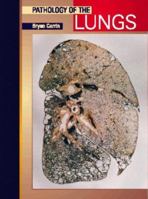Pathology of the Lungs 0443074763 Book Cover