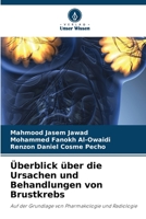 Überblick über die Ursachen und Behandlungen von Brustkrebs (German Edition) 6206405184 Book Cover