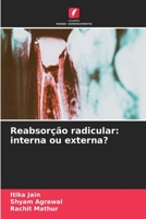 Reabsorção radicular: interna ou externa? 6206097870 Book Cover