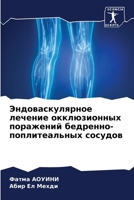 Эндоваскулярное лечени&# 6205058456 Book Cover