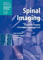 Spinal Imaging: Diagnostic Imaging of the Spine and Spinal Cord (Medical Radiology / Diagnostic Imaging) 3540213449 Book Cover