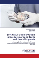 Soft tissue augmentation procedures around teeth and dental implants 6207468082 Book Cover