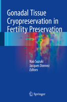 Gonadal Tissue Cryopreservation in Fertility Preservation 4431559612 Book Cover