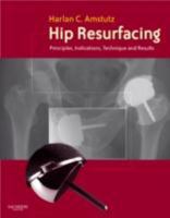 Hip Resurfacing: Principles, Indications, Technique and Results Book and DVD 1416047247 Book Cover
